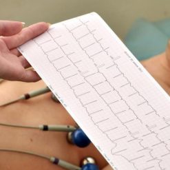 ECG